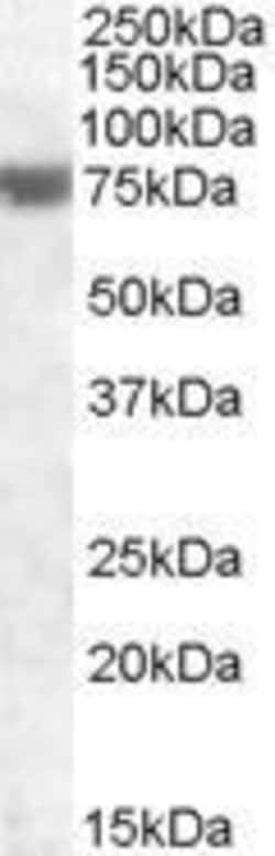 FEM1A Polyclonal Antibody, Invitrogen 100 &mu;g; Unconjugated:Antibodies,