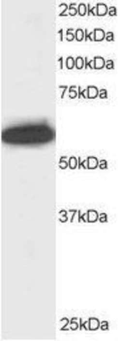 NUP50 Polyclonal Antibody, Invitrogen 100 &mu;g; Unconjugated:Antibodies,