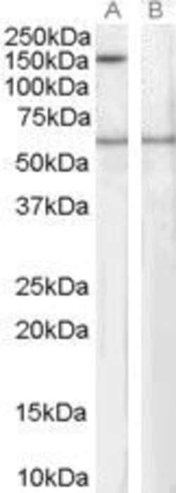 SIPA1 Polyclonal Antibody, Invitrogen 100 &mu;g; Unconjugated:Antibodies,