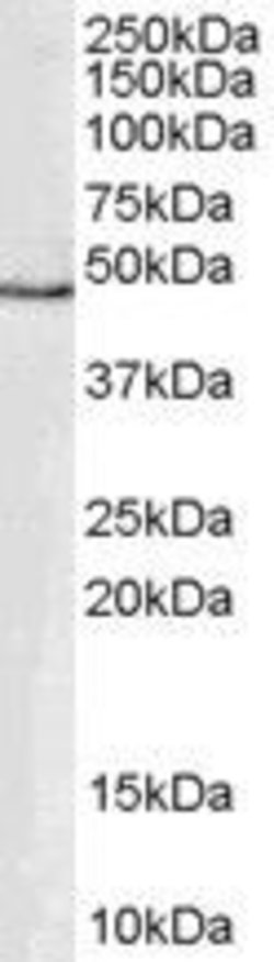 GATA1 Polyclonal Antibody, Invitrogen™ 100 μg; Unconjugated Fisher