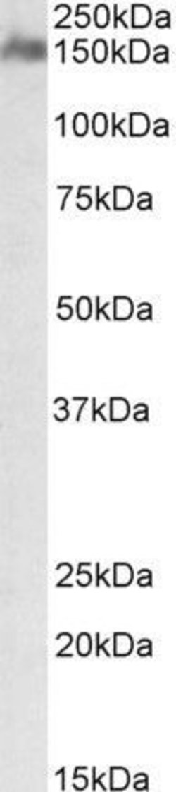 CSMD1 Polyclonal Antibody, Invitrogen 100 &mu;g; Unconjugated:Antibodies,