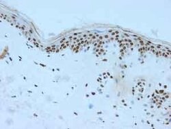 hnRNP A1 Polyclonal Antibody, Invitrogen 100 &mu;g; Unconjugated:Antibodies,