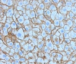 Invitrogen beta Catenin Polyclonal Antibody 100 &mu;g; Unconjugated:Antibodies,