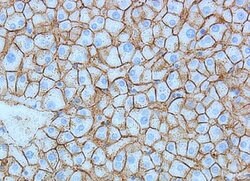 Invitrogen E-cadherin Polyclonal Antibody 100 &mu;g | Buy Online | Invitrogen&trade; | Fisher Scientific