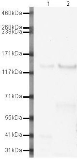 Invitrogen E-cadherin Polyclonal Antibody 100 &mu;g | Buy Online | Invitrogen&trade; | Fisher Scientific
