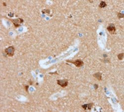 Invitrogen Nucleolin Polyclonal Antibody 100 μg; Unconjugated:Antibodies,