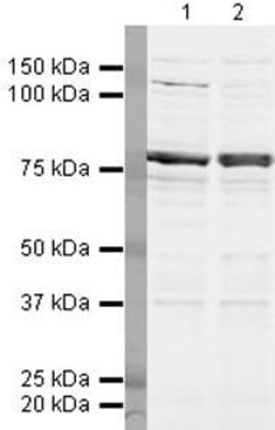 DDX17 Polyclonal Antibody:Antibodies, Polyclonal