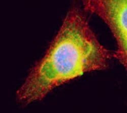 Invitrogen UBC9 Polyclonal Antibody 100 &mu;g; Unconjugated:Antibodies,