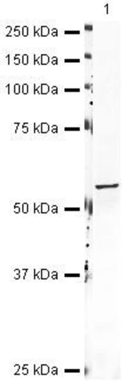 Invitrogen Aromatase Polyclonal Antibody 100 &mu;g; Unconjugated:Antibodies,