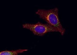 Invitrogen Galectin 8 Polyclonal Antibody 100 &mu;g; Unconjugated:Antibodies,