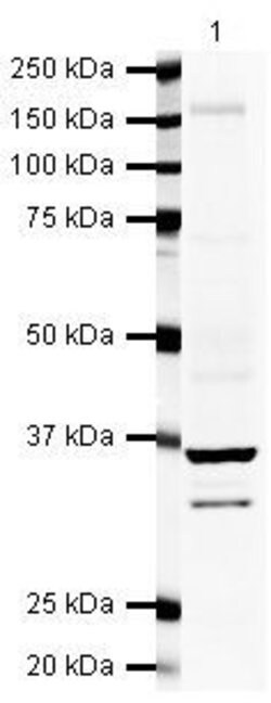 Invitrogen Galectin 8 Polyclonal Antibody 100 &mu;g; Unconjugated:Antibodies,