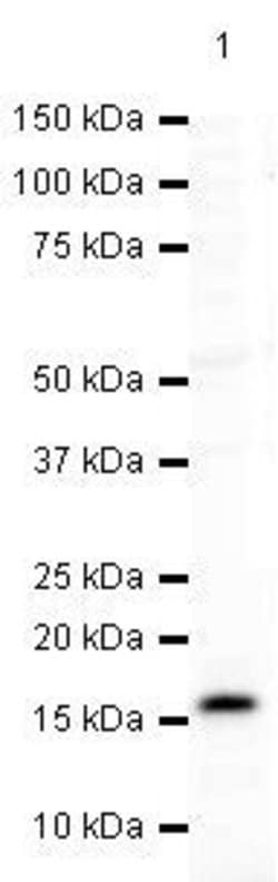 Invitrogen gamma Synuclein Polyclonal Antibody 100 &mu;g; Unconjugated:Antikroppar