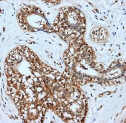 Invitrogen LDHA Polyclonal Antibody 100 &mu;g; Unconjugated:Anticuerpos