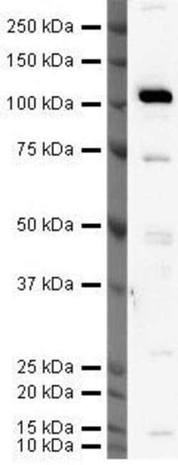 Invitrogen hCV-2 Polyclonal Antibody 100 &mu;g; Unconjugated:Antibodies,