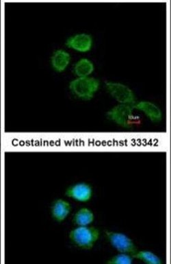 Apelin Receptor, Polyclonal, Invitrogen 100&mu;g; Unconjugated:Antibodies,