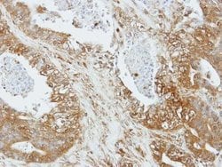 Apelin Receptor, Polyclonal, Invitrogen 100&mu;g; Unconjugated:Antibodies,