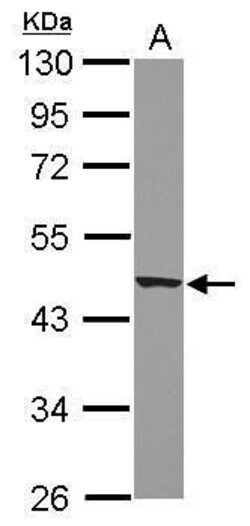 Apelin Receptor, Polyclonal, Invitrogen 100&mu;g; Unconjugated:Antibodies,