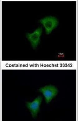 DKK3 Rabbit anti-Human, Mouse, Polyclonal, Invitrogen 100 &mu;L; Unconjugated:Antibodies