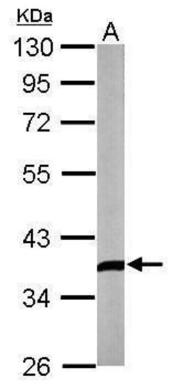 DKK3 Rabbit anti-Human, Mouse, Polyclonal, Invitrogen 100 &mu;L; Unconjugated:Antibodies