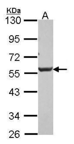 DKK3 Rabbit anti-Human, Mouse, Polyclonal, Invitrogen 100 &mu;L; Unconjugated:Antibodies
