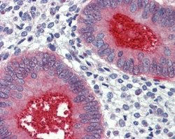 HPa2, Polyclonal, Invitrogen 100&mu;L; Unconjugated:Antibodies, Polyclonal