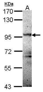 Protein Kinase D2 Rabbit Anti Human Polyclonal Invitrogen 100 Ml Unconjugated Primary Antibodies Pq To Pr Fisher Scientific