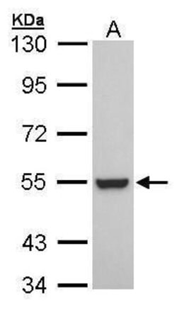 RXRB Polyclonal Antibody, Invitrogen 100 μL; Unconjugated:Antibodies,