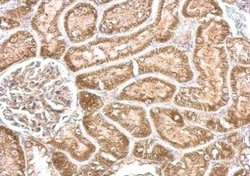 CYP24A1 Polyclonal Antibody, Invitrogen 100 &mu;L; Unconjugated:Antibodies,