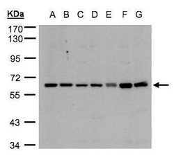 CYP24A1 Polyclonal Antibody, Invitrogen 100 &mu;L; Unconjugated:Antibodies,