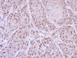 GLE1 Polyclonal Antibody, Invitrogen 100 &mu;L; Unconjugated:Antibodies,