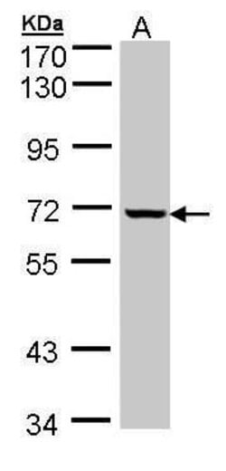GLE1 Polyclonal Antibody, Invitrogen 100 &mu;L; Unconjugated:Antibodies,