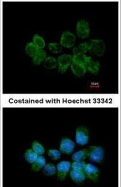 STX5 Polyclonal Antibody, Invitrogen 100 &mu;L | Buy Online | Invitrogen | Fisher Scientific