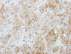 STX5 Polyclonal Antibody, Invitrogen 100 &mu;L | Buy Online | Invitrogen | Fisher Scientific