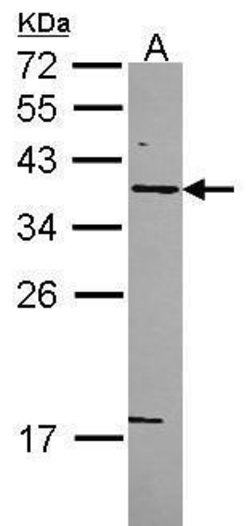 STX5 Polyclonal Antibody, Invitrogen 100 &mu;L | Buy Online | Invitrogen | Fisher Scientific