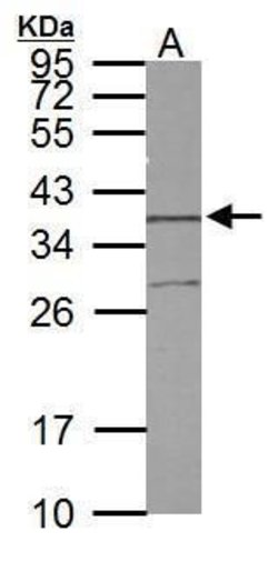 STX5 Polyclonal Antibody, Invitrogen 100 &mu;L | Buy Online | Invitrogen | Fisher Scientific