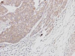 Btk Polyclonal Antibody, Invitrogen 100 &mu;L; Unconjugated:Antibodies,