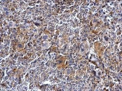Btk Polyclonal Antibody, Invitrogen 100 &mu;L; Unconjugated:Antibodies,