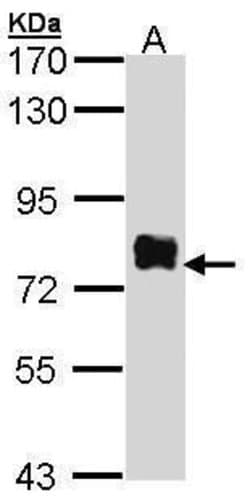 Btk Polyclonal Antibody, Invitrogen 100 &mu;L; Unconjugated:Antibodies,