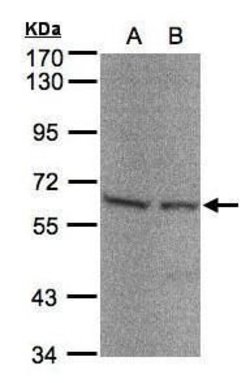 Seryl-tRNA synthetase Polyclonal Antibody, Invitrogen 100 &mu;L; Unconjugated:Antibodies,