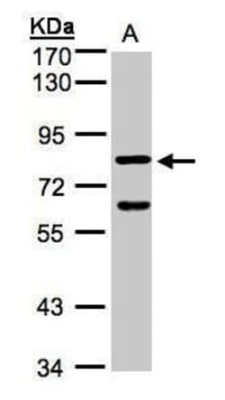 Cyclin F Rabbit anti-Human, Polyclonal, Invitrogen 100 &mu;L; Unconjugated:Antibodies,
