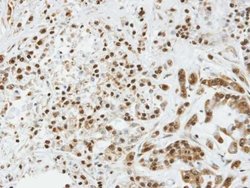 SOCS3 Rabbit anti-Human, Polyclonal, Invitrogen 100 &mu;L; Unconjugated:Antibodies,