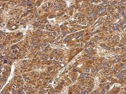 Mast Cell Chymase Rabbit anti-Human, Polyclonal, Invitrogen 100 &mu;L;