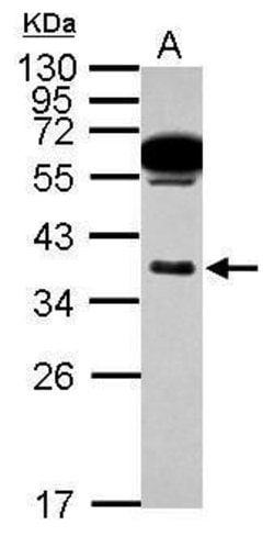 Mast Cell Chymase Rabbit anti-Human, Polyclonal, Invitrogen 100 &mu;L;