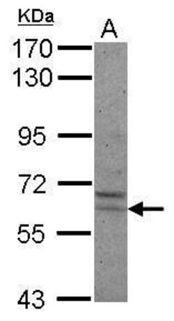 PRAME Polyclonal Antibody, Invitrogen 100 &mu;L; Unconjugated:Antibodies,