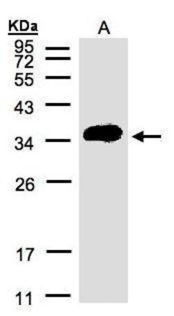 ATP6IP2 Rabbit anti-Human, Polyclonal, Invitrogen 100 &mu;L; Unconjugated:Antibodies,