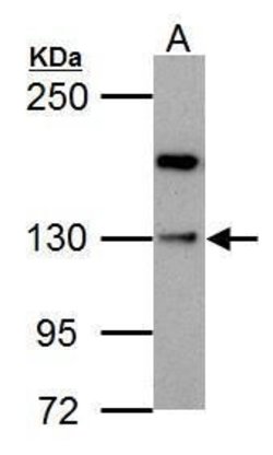 HIPK1 Polyclonal Antibody, Invitrogen 100 &mu;L; Unconjugated:Anticuerpos