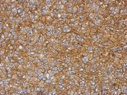 TYROBP Rabbit anti-Human, Polyclonal, Invitrogen 100 &mu;L; Unconjugated:Antibodies,