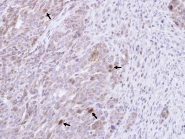 GRB14 Polyclonal Antibody, Invitrogen™ 100 μL; Unconjugated Primary ...