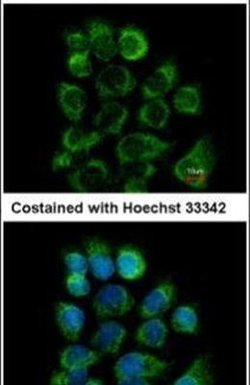 CD46, Polyclonal, Invitrogen 100&mu;L; Unconjugated:Antibodies, Polyclonal