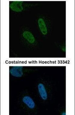 TIA-1 Polyclonal Antibody, Invitrogen 100 &mu;L | Buy Online | Invitrogen | Fisher Scientific
